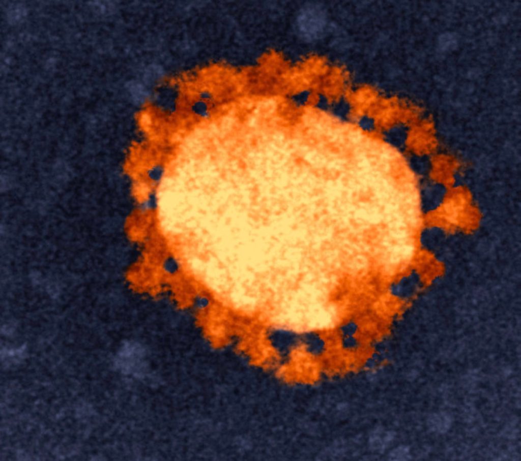 Thumbnail for Tourism dries up, so Trad offers payroll tax holiday