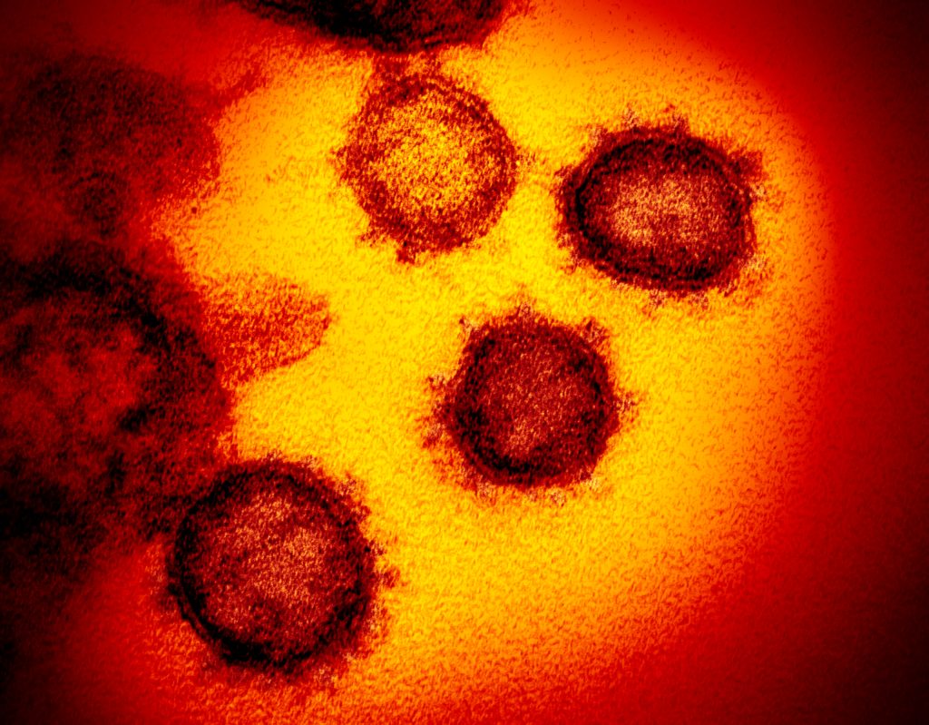 WHO experts say the coronavirus may never be defeated. (Photo: NIAID-RML via AP)