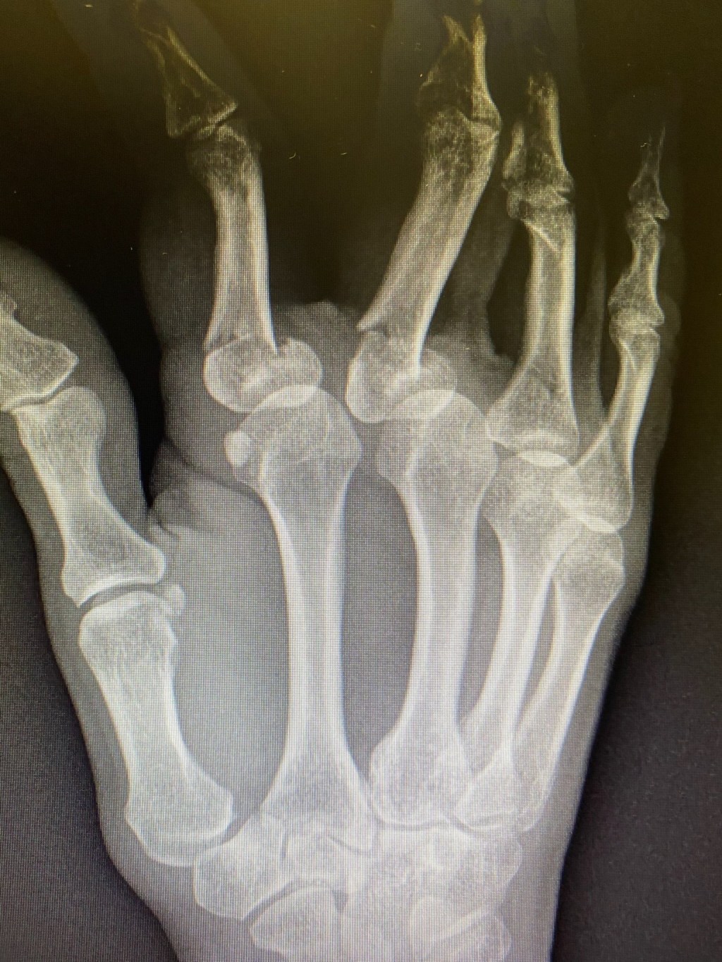 Thumbnail for How the hand of justice caused a (temporary) cabinet reshuffle