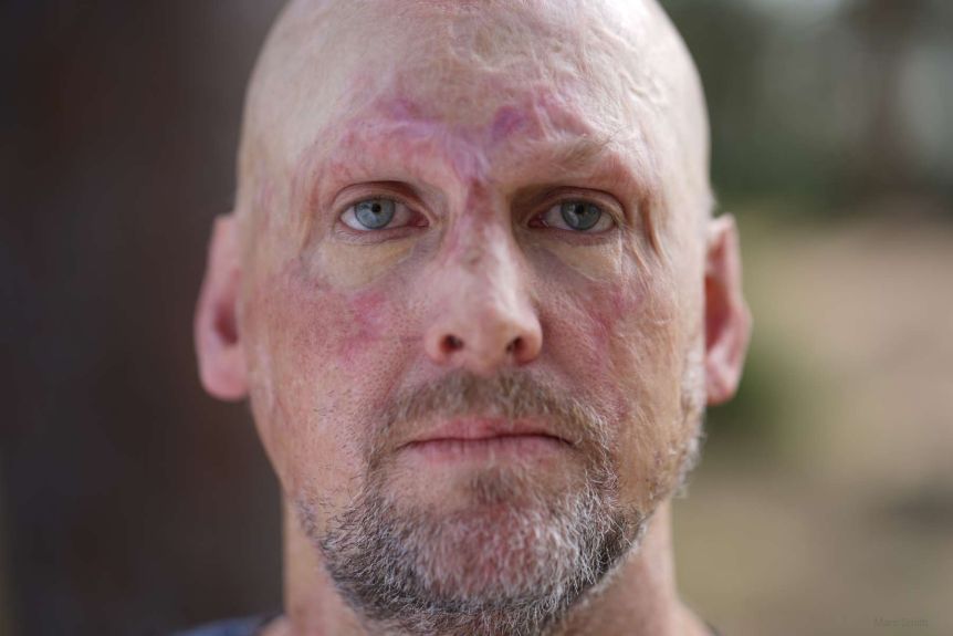 Thumbnail for Celebrity chef Matt Golinski axed as Gympie regional food ambassador