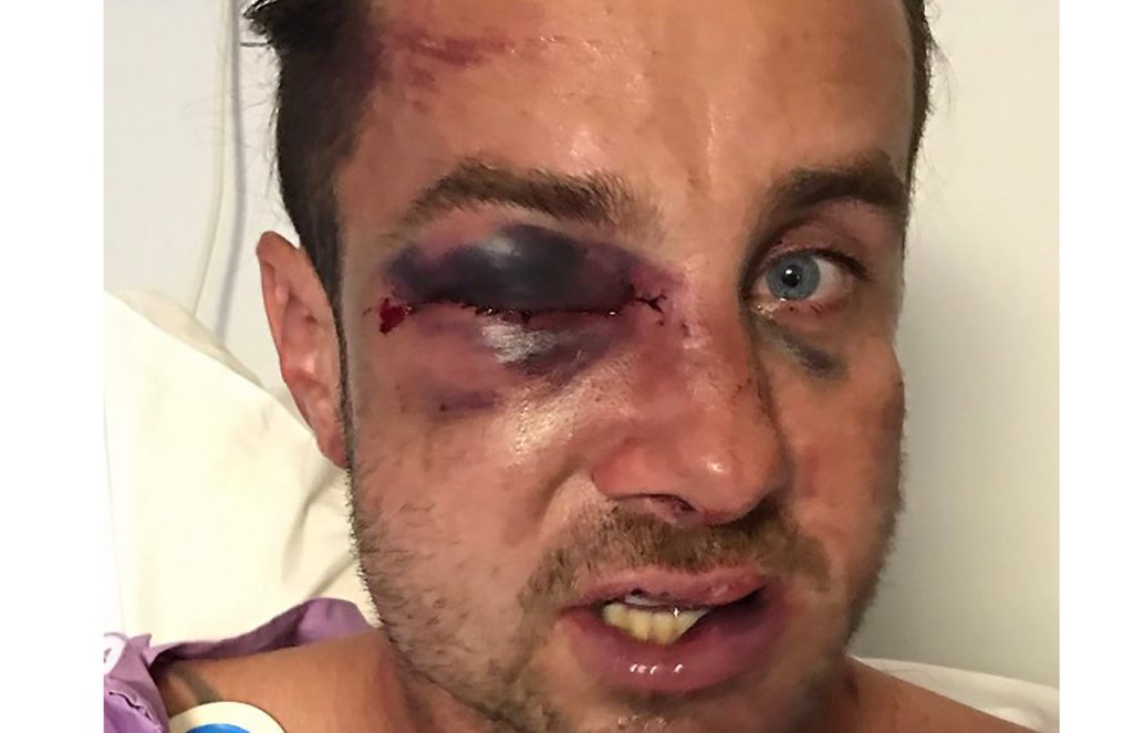 Thumbnail for How a Brisbane dad took his son to footy and ended up looking like this