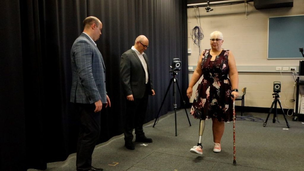 Thumbnail for Griffith steps up with bionic limb design