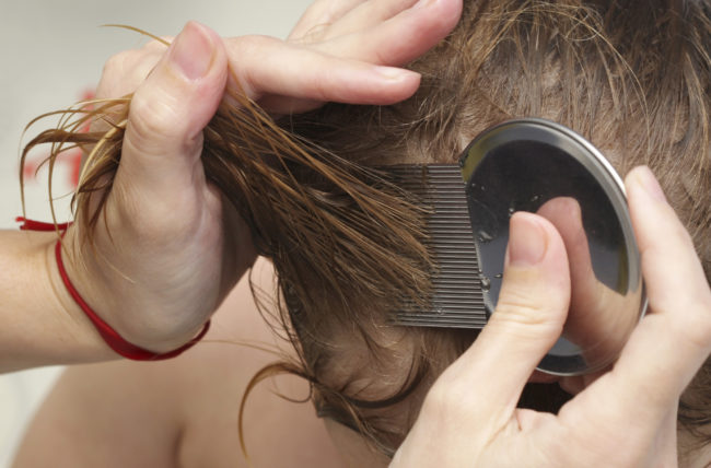 Thumbnail for Lice, damn lice and statistics – all you need to know about nits but were afraid to ask