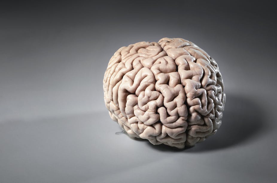 Thumbnail for Scientists find gene mutation that cuts Alzheimer’s risk by 70 per cent