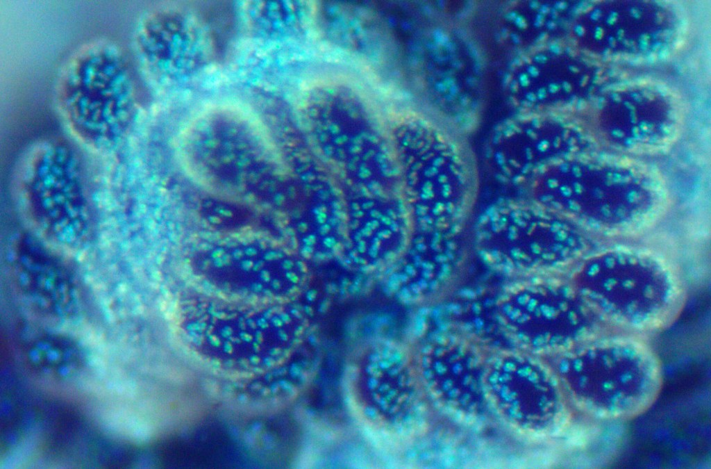 Thumbnail for Meet the Octocoral: Sunshine Coast rock pool creatures ‘the only ones on Earth’