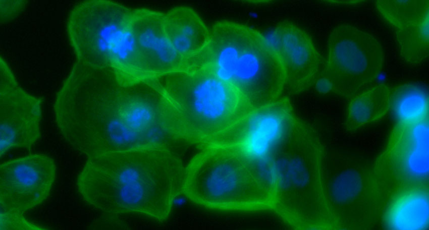 Camera Name: 
Numerical Aperture: 0.45
Refractive Index: 1
Number of Picture Planes: 2
Plane #1:
 Name: Green
 Component Count: 1
 Modality: Widefield Fluorescence
Plane #2:
 Name: Blue
 Component Count: 1
 Modality: Widefield Fluorescence