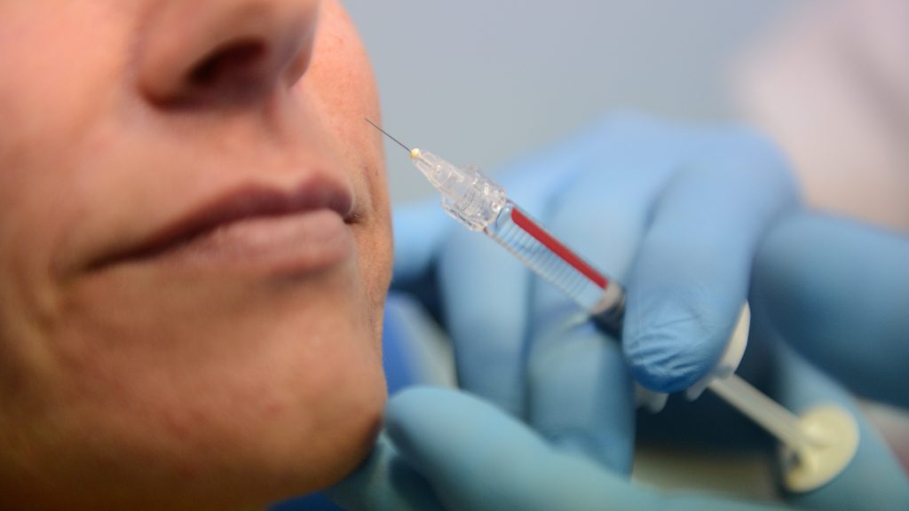 Dr. Peter Bakaric injects collagen into a patient at the Collagen Face Centre in Sydney, Thursday, April 12, 2012. (AAP Image/Dean Lewins) NO ARCHIVING