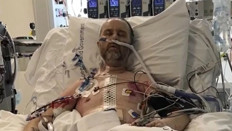 Adam Retmock is the second patient to die from a fungal cluster at The Prince Charles Hospital. Picture: 7 News
