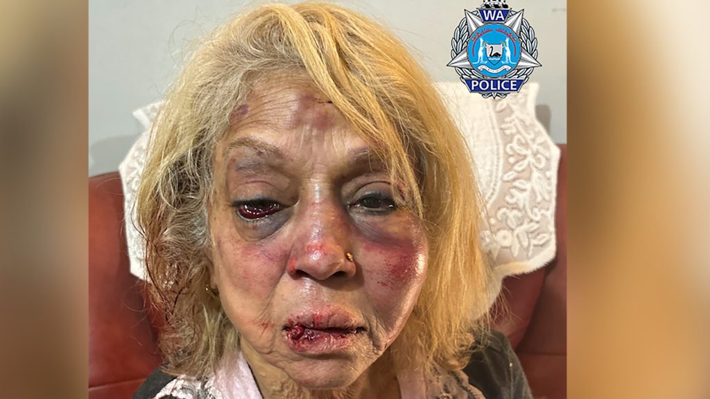 Thumbnail for Shooting the messenger: PM blasts prosecutors over bail for detainee who did this