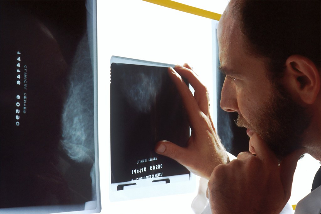 Thumbnail for Hospital set for AI medical scans in ‘Australian first’