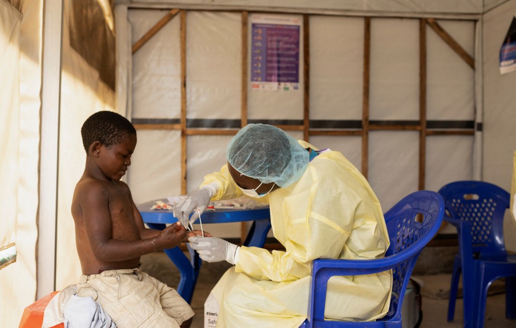 Thumbnail for Mpox strikes for second time in 12 months, but this time it’s a global emergency